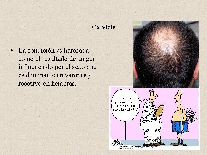 Calvicie • La condición es heredada como el resultado de un gen influenciado por