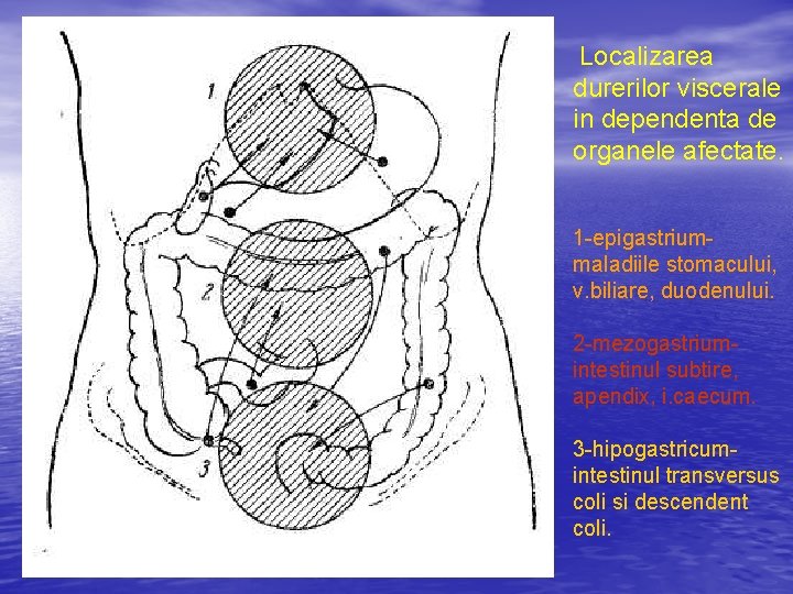 Localizarea durerilor viscerale in dependenta de organele afectate. 1 -epigastriummaladiile stomacului, v. biliare, duodenului.