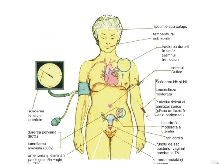 Simptomele clinice carcteristice pentru abdomenul acut în ginecologie PLANUL 3. 1. Actualitatea problemei. 1.