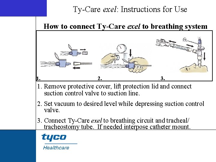 Ty-Care exel: Instructions for Use How to connect Ty-Care exel to breathing system 1.