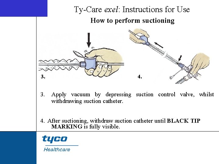 Ty-Care exel: Instructions for Use How to perform suctioning 3. 4. Apply vacuum by