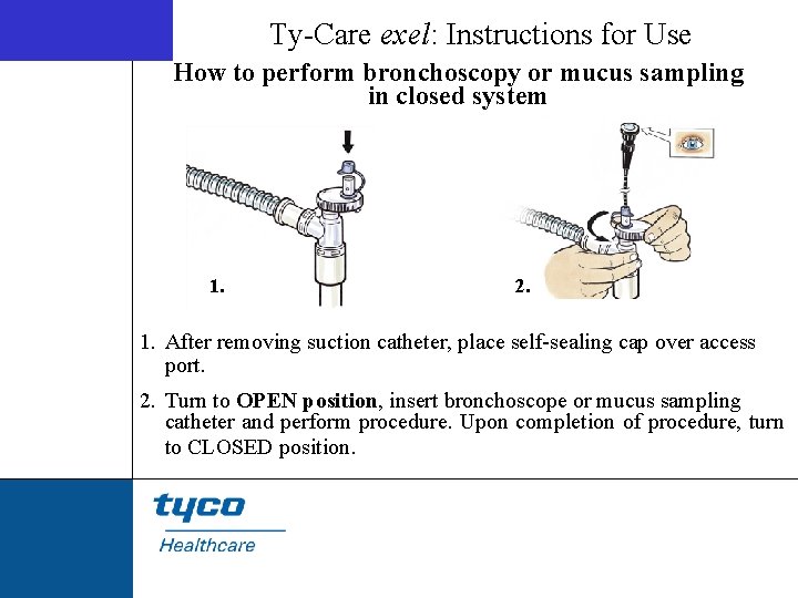Ty-Care exel: Instructions for Use How to perform bronchoscopy or mucus sampling in closed