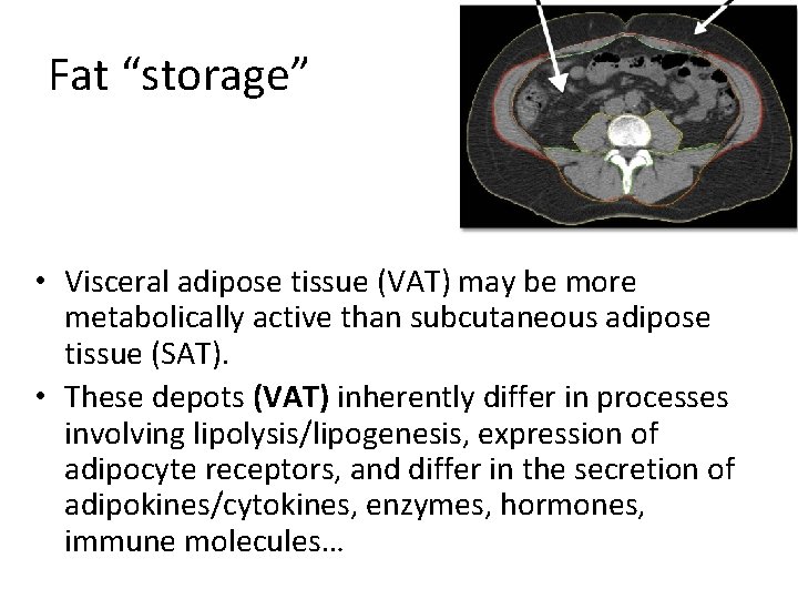 Fat “storage” • Visceral adipose tissue (VAT) may be more metabolically active than subcutaneous