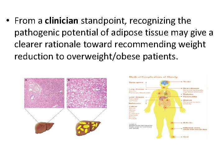  • From a clinician standpoint, recognizing the pathogenic potential of adipose tissue may