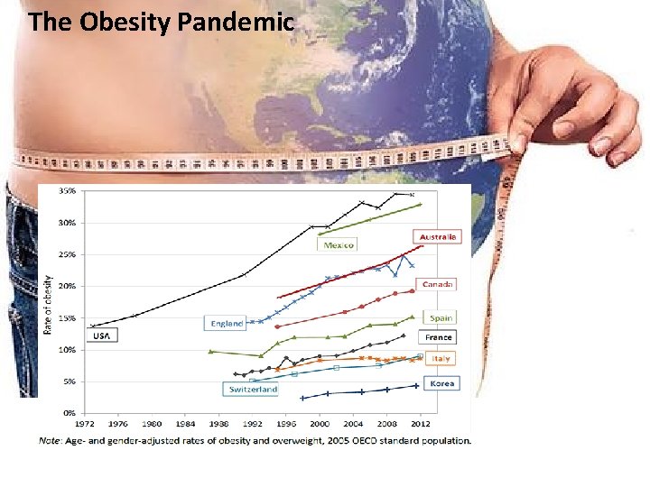 The Obesity Pandemic 