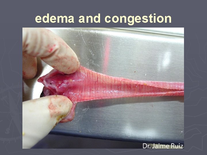edema and congestion 