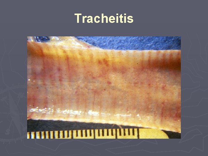 Tracheitis 