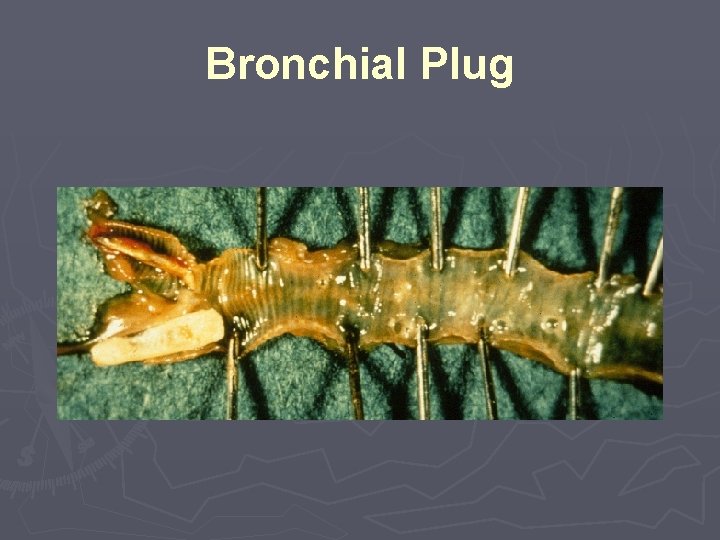 Bronchial Plug 