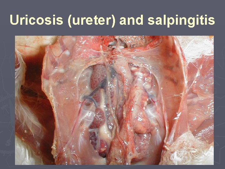 Uricosis (ureter) and salpingitis 