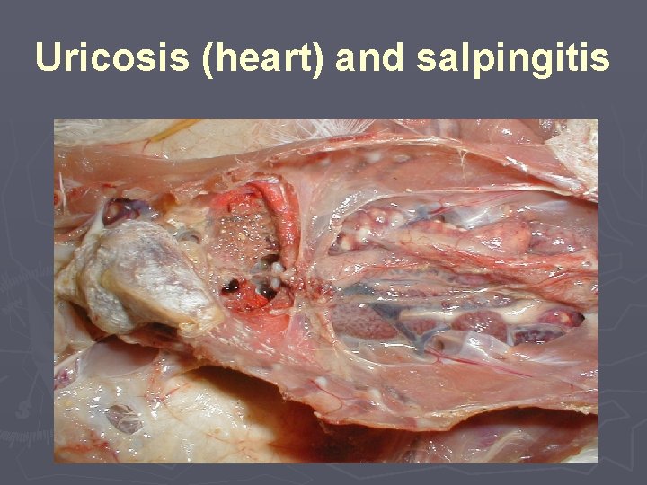 Uricosis (heart) and salpingitis 