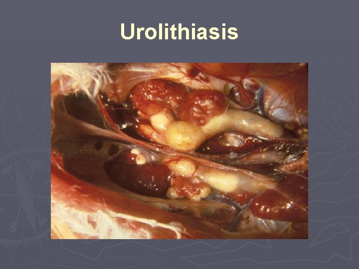 Urolithiasis 