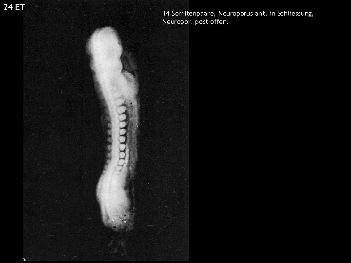 24 ET 14 Somitenpaare, Neuroporus ant. in Schliessung, Neuropor. post offen. 24 ET 