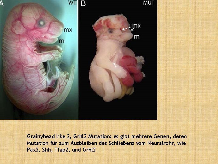 Grainyhead like 2, Grhl 2 Mutation: es gibt mehrere Genen, deren Mutation für zum