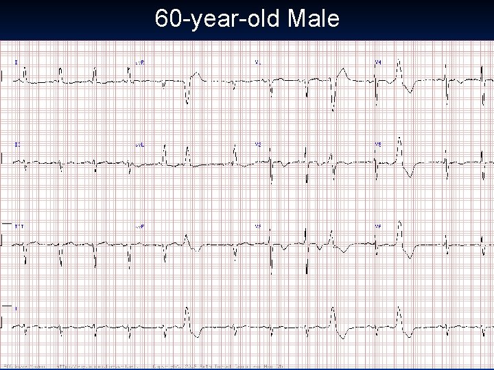 60 -year-old Male 