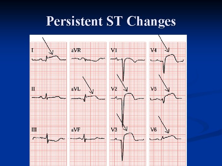 Persistent ST Changes 