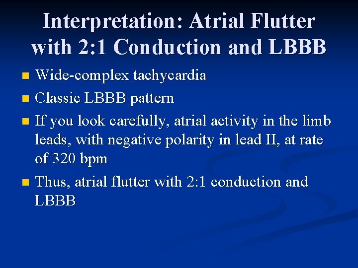 Interpretation: Atrial Flutter with 2: 1 Conduction and LBBB Wide-complex tachycardia n Classic LBBB