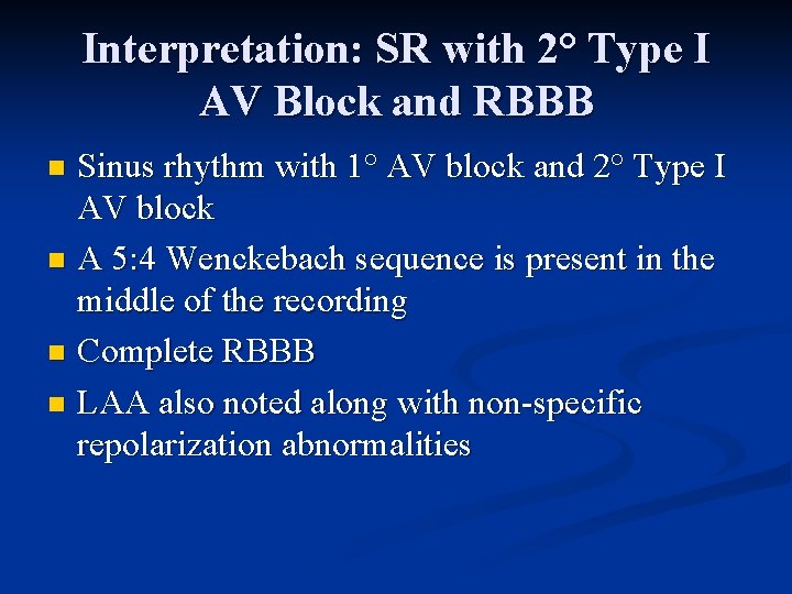 Interpretation: SR with 2° Type I AV Block and RBBB Sinus rhythm with 1°