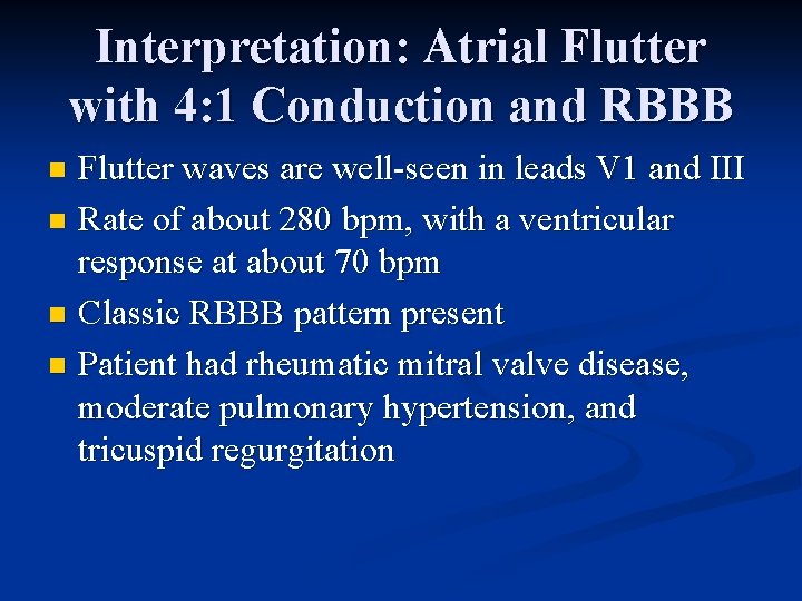 Interpretation: Atrial Flutter with 4: 1 Conduction and RBBB Flutter waves are well-seen in