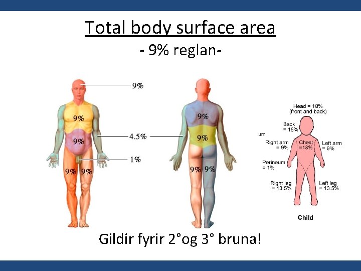 Total body surface area - 9% reglan- Gildir fyrir 2°og 3° bruna! 