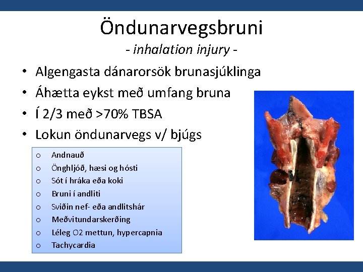 Öndunarvegsbruni - inhalation injury - • • Algengasta dánarorsök brunasjúklinga Áhætta eykst með umfang