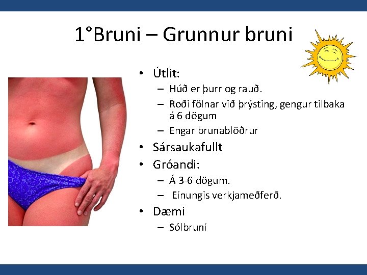 1°Bruni – Grunnur bruni • Útlit: – Húð er þurr og rauð. – Roði