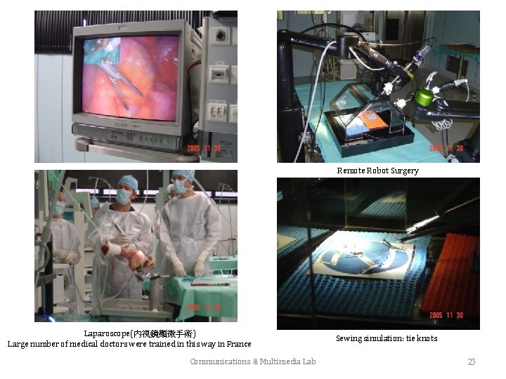 Remote Robot Surgery Laparoscope(內視鏡顯微手術) Large number of medical doctors were trained in this way