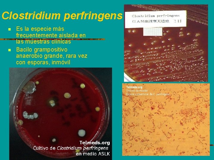 Clostridium perfringens n n Es la especie más frecuentemente aislada en las muestras clínicas