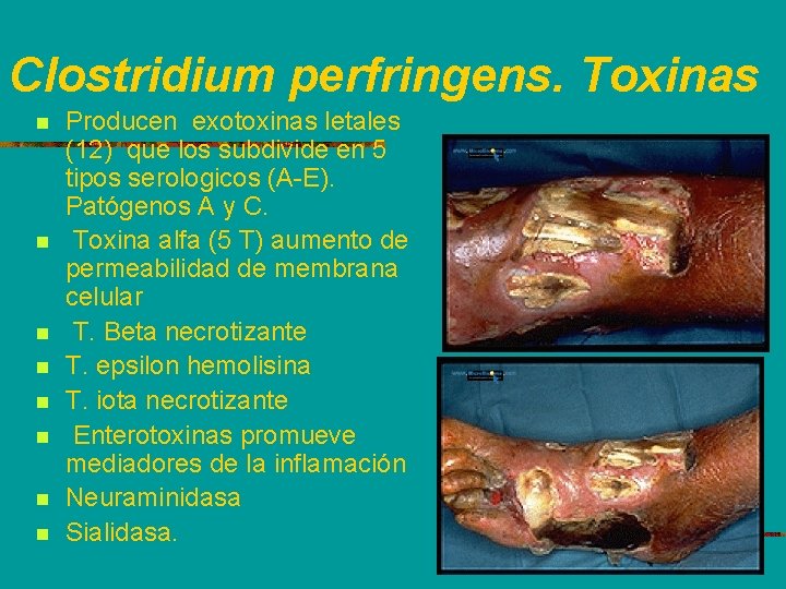 Clostridium perfringens. Toxinas n n n n Producen exotoxinas letales (12) que los subdivide