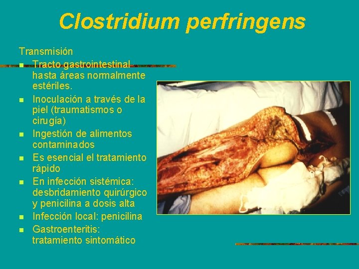 Clostridium perfringens Transmisión n Tracto gastrointestinal hasta áreas normalmente estériles. n Inoculación a través