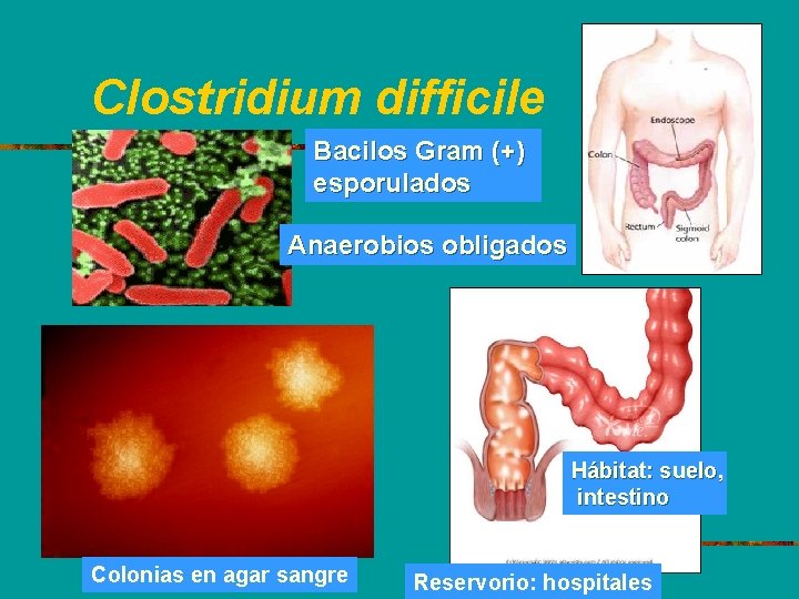 Clostridium difficile Bacilos Gram (+) esporulados Anaerobios obligados Hábitat: suelo, intestino Colonias en agar