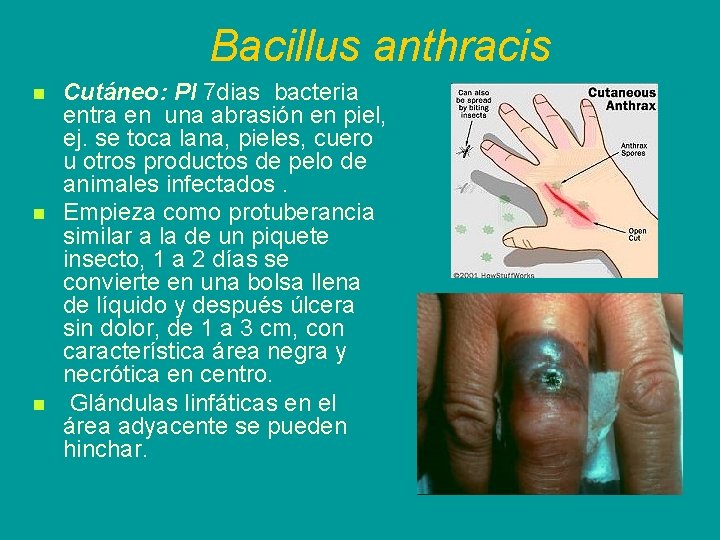 Bacillus anthracis n n n Cutáneo: PI 7 dias bacteria entra en una abrasión