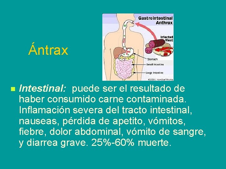 Ántrax n Intestinal: puede ser el resultado de haber consumido carne contaminada. Inflamación severa
