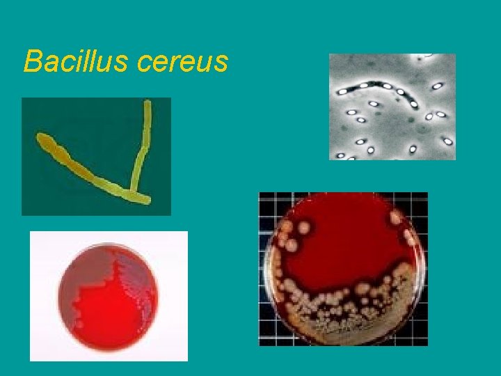 Bacillus cereus 