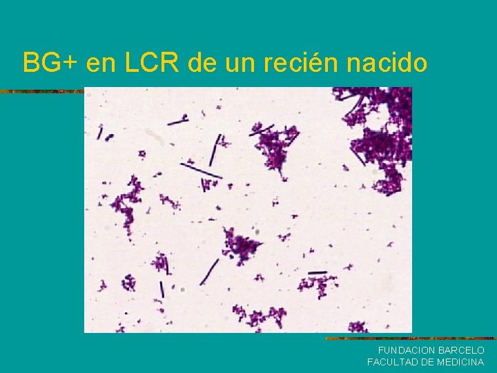 BG+ en LCR de un recién nacido FUNDACION BARCELO FACULTAD DE MEDICINA 