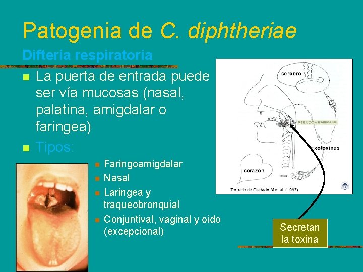 Patogenia de C. diphtheriae Difteria respiratoria n La puerta de entrada puede ser vía