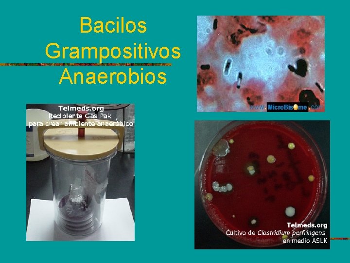 Bacilos Grampositivos Anaerobios 