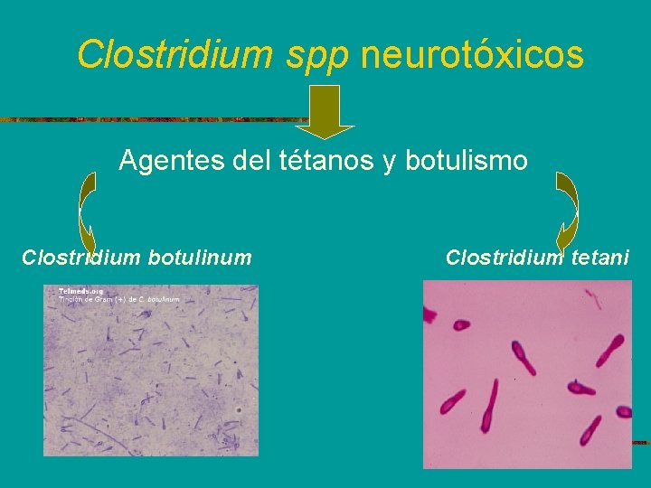 Clostridium spp neurotóxicos Agentes del tétanos y botulismo Clostridium botulinum Clostridium tetani 