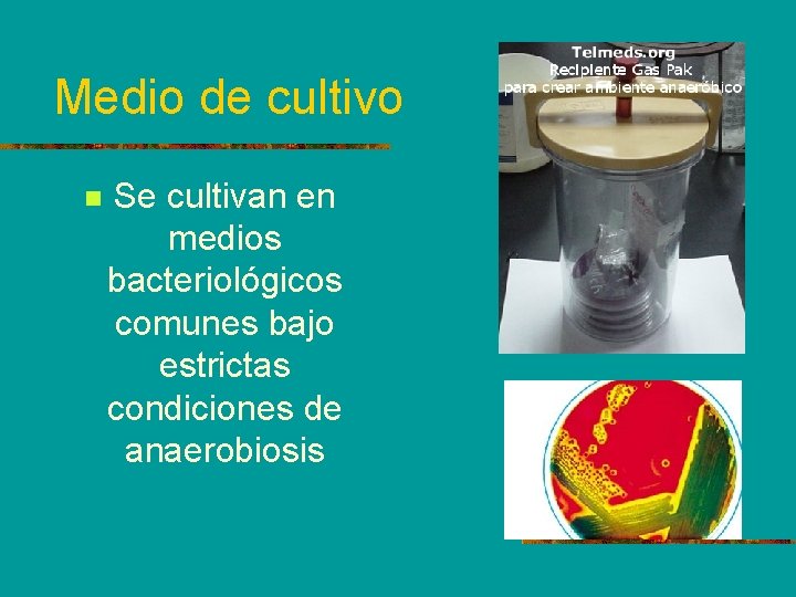 Medio de cultivo n Se cultivan en medios bacteriológicos comunes bajo estrictas condiciones de