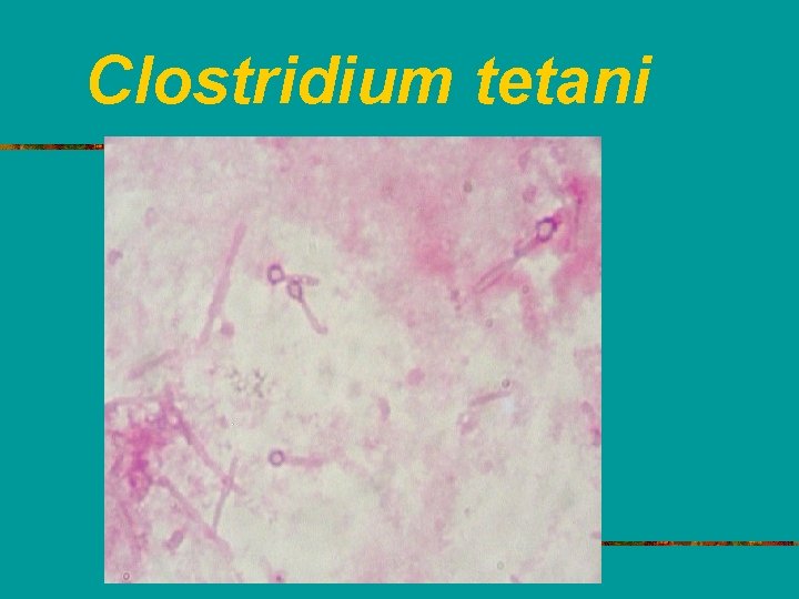 Clostridium tetani 