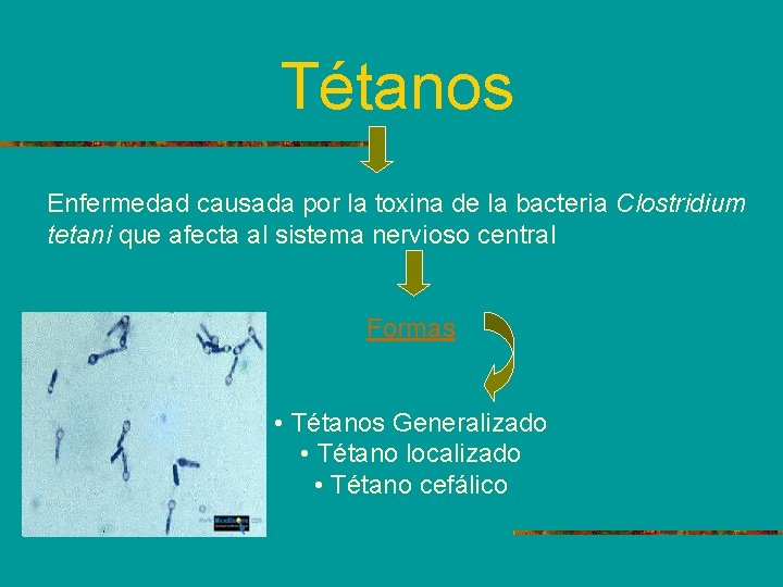Tétanos Enfermedad causada por la toxina de la bacteria Clostridium tetani que afecta al