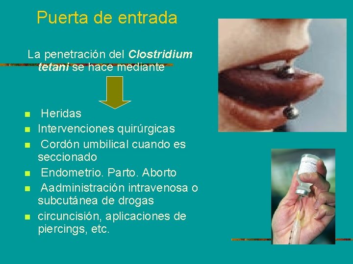 Puerta de entrada La penetración del Clostridium tetani se hace mediante n n n