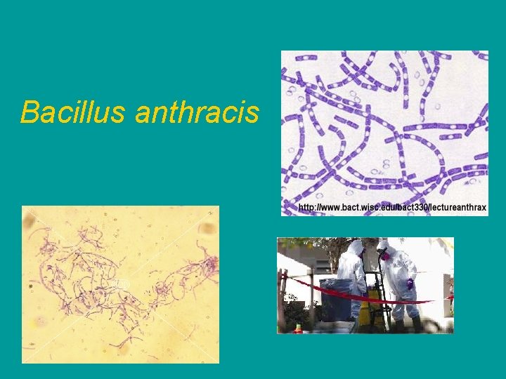 Bacillus anthracis 