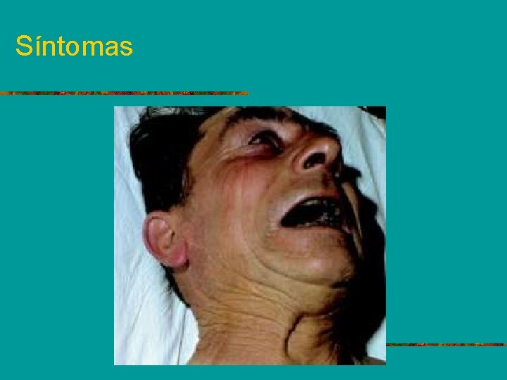 Síntomas 