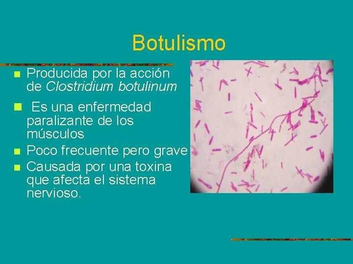 Botulismo Producida por la acción de Clostridium botulinum n Es una enfermedad paralizante de