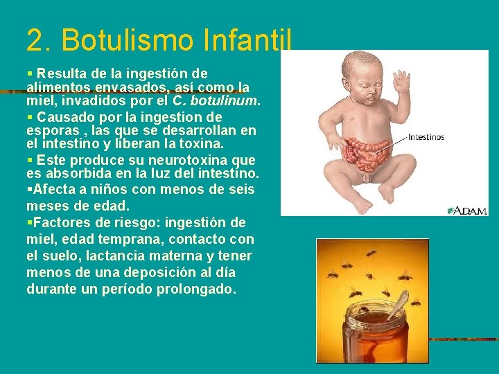 2. Botulismo Infantil § Resulta de la ingestión de alimentos envasados, así como la