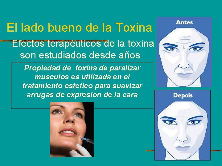 El lado bueno de la Toxina Efectos terapéuticos de la toxina son estudiados desde