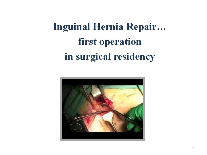 Inguinal Hernia Repair… first operation in surgical residency 5 