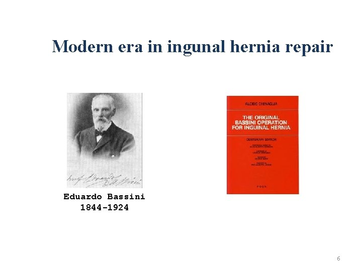 Modern era in ingunal hernia repair Eduardo Bassini 1844 -1924 6 