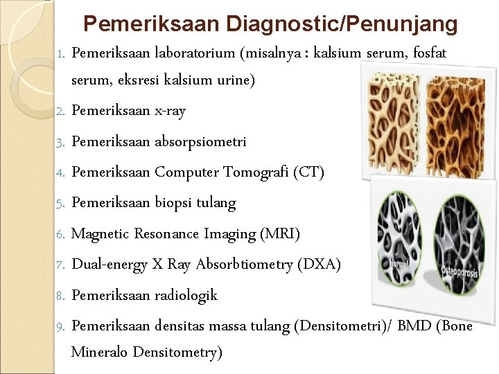 Pemeriksaan Diagnostic/Penunjang 1. Pemeriksaan laboratorium (misalnya : kalsium serum, fosfat serum, eksresi kalsium urine)