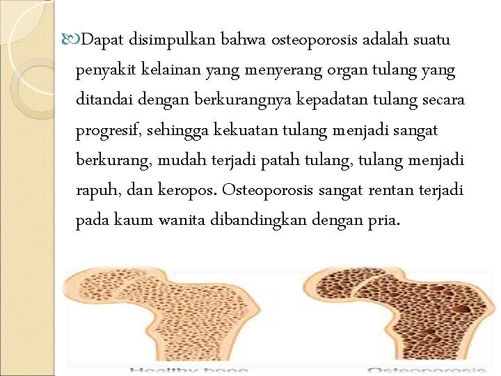  Dapat disimpulkan bahwa osteoporosis adalah suatu penyakit kelainan yang menyerang organ tulang yang